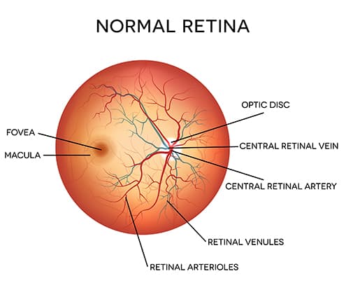 Diagram of a Normal Retina